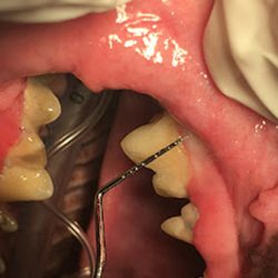 Diş Eti Hastalıkları