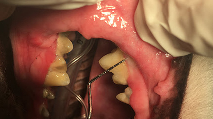 Diş Eti Hastalıkları